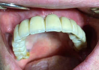 Trattamento ortodontico